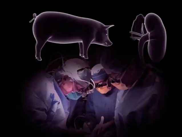 زراعة  أعضاء الخنزير في جسم الإنسان