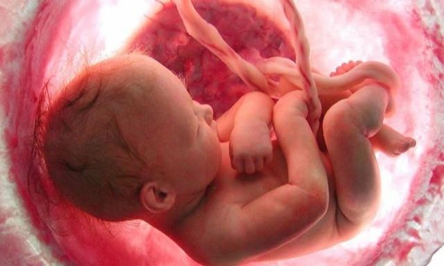 حكم إجهاض الجنين غير مكتمل النمو