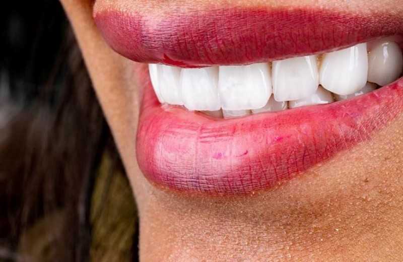 ماهي سناب اون سمايل خطواتها واسعارها في مصر